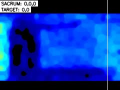 tof_sacrum
